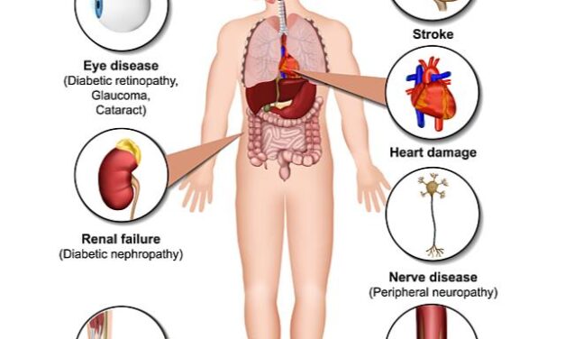 What Every Diabetic Should Know About Complications