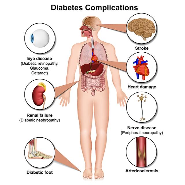 What Every Diabetic Should Know About Complications